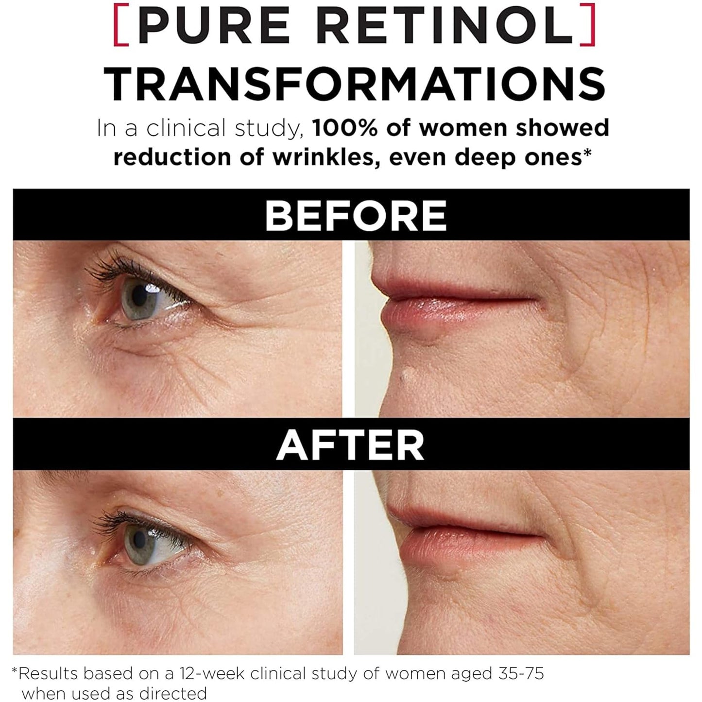 Revitalift Triple Power LZR Retinol Night Serum