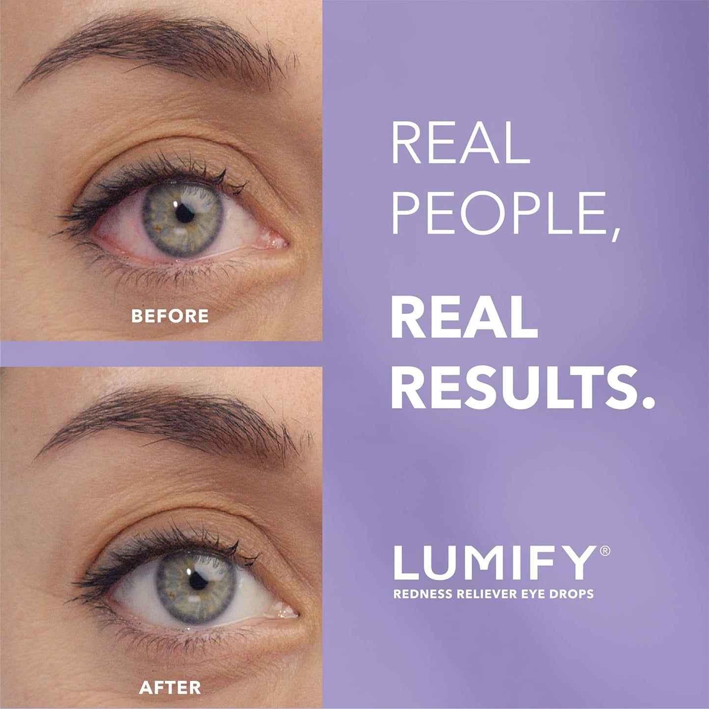 Eye Drops for Red Eyes