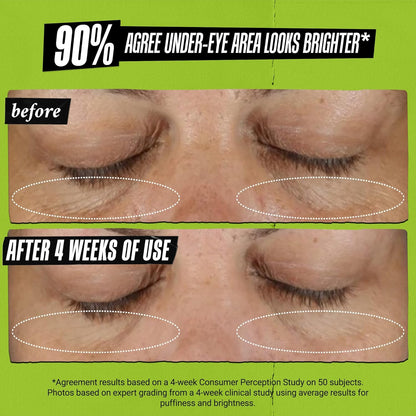 Avocado Eye Cream for Brightening & Depuffing 28 g