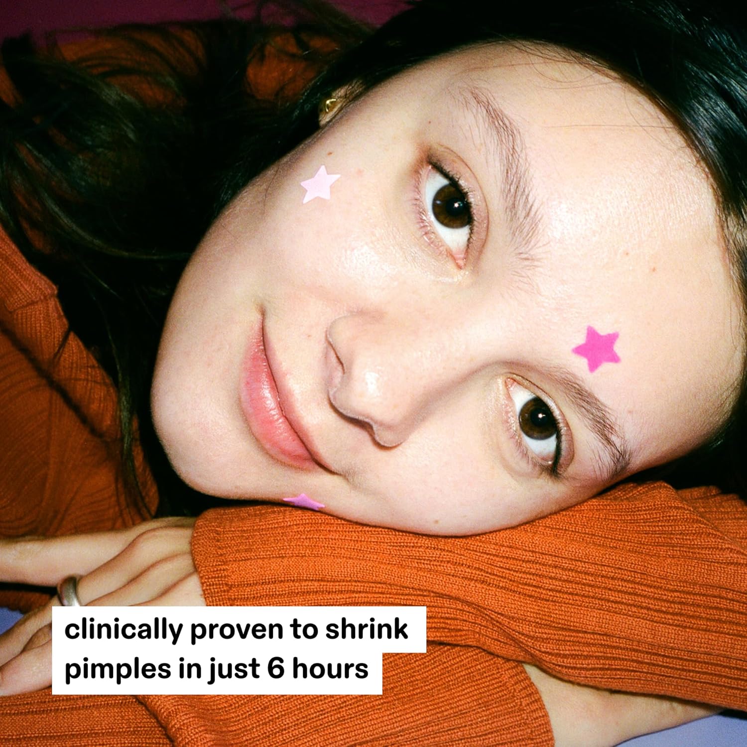 Hydro-Star® Pink Pimple Patches