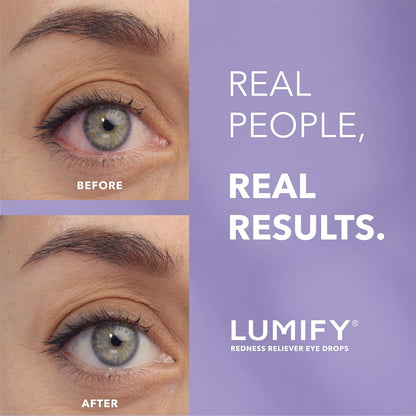 Eye Drops for Red Eyes